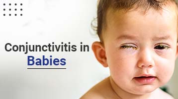 Conjunctivitis in Babies