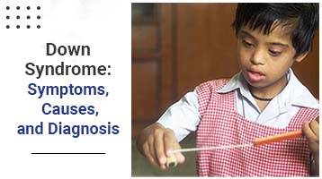 Down Syndrome: Symptoms, Causes, and Diagnosis